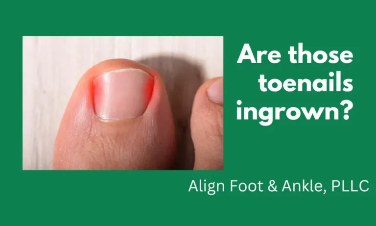 ARE THOSE TOENAILS INGROWN?