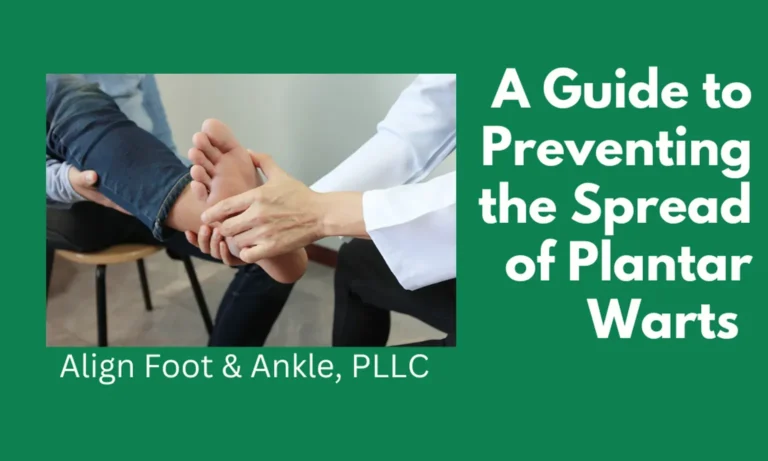 A GUIDE TO PREVENTING THE SPREAD OF PLANTAR WARTS