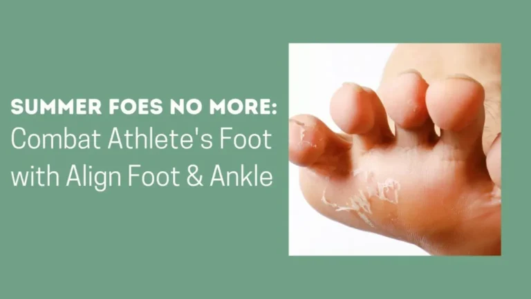 SUMMER FOOT CARE: PREVENTING AND TREATING ATHLETE’S FOOT WITH ALIGN FOOT & ANKLE CLINIC