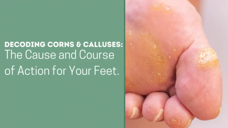 UNRAVELING THE TALE OF FOOT CORNS AND CALLUSES: DISCOVERING THE RIGHT SOLUTION FOR YOUR FEET