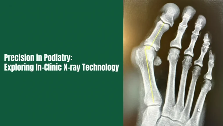 PRECISION IN PODIATRY: EXPLORING IN-CLINIC X-RAY TECHNOLOGY AT ALIGN FOOT & ANKLE CLINIC