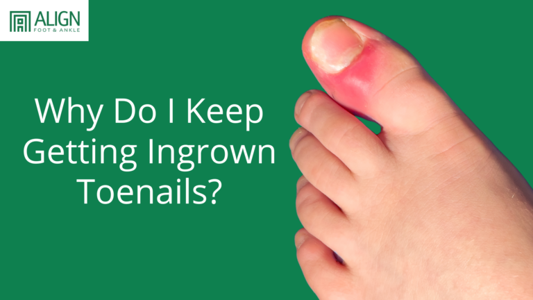 Why Do I Keep Getting Ingrown Toenails?