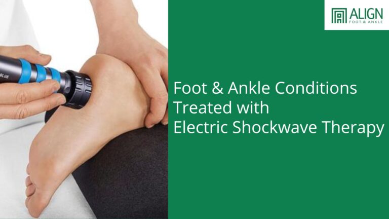 Common Foot and Ankle Conditions That Can Be Helped by Shockwave Therapy