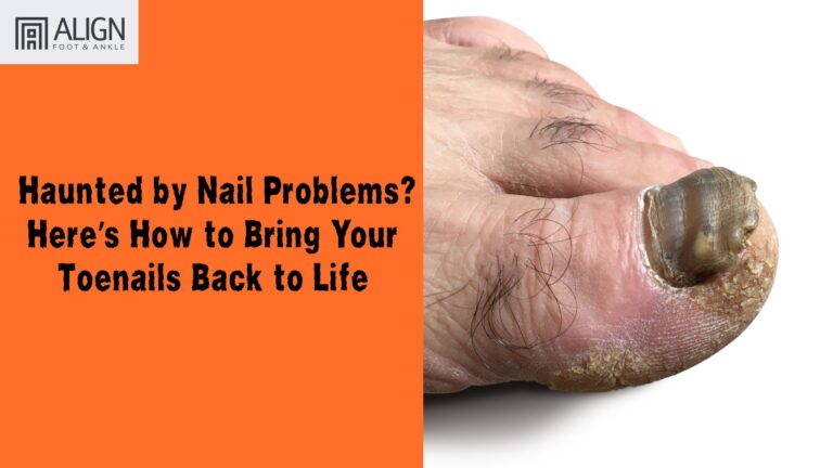 Haunted by Nail Problems? Here’s How to Bring Your Toenails Back to Life