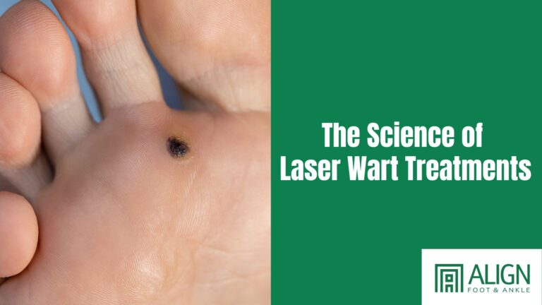 The Science of Laser Wart Treatments at Align Foot & Ankle Clinic