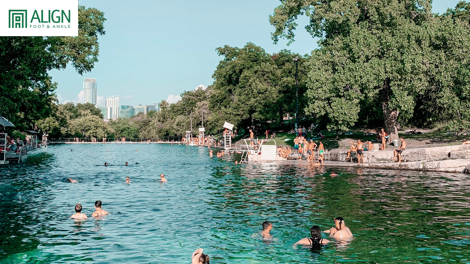 Don’t Fry Day: Why Foot Sun Protection Matters More Than You Think