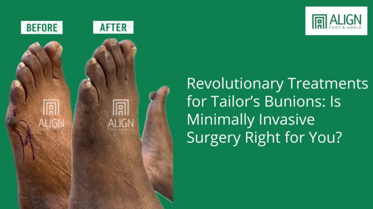 Revolutionary Treatments for Tailor’s Bunions: Is Minimally Invasive Surgery Right for You?