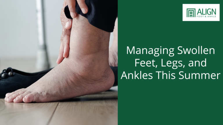 Managing Swollen Feet, Legs, and Ankles: Causes, Risks, Prevention and Treatments