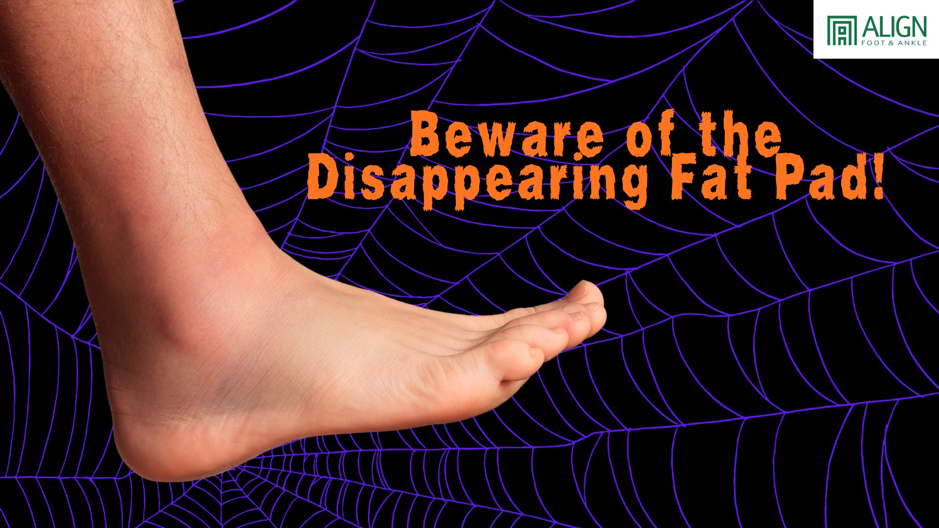 Beware the Disappearing Fat Pad: The Silent Scare Beneath Your Feet